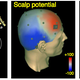 Illustration for article titled Lucid Dreaming Can Be Induced By Zapping Brains With Gamma Waves